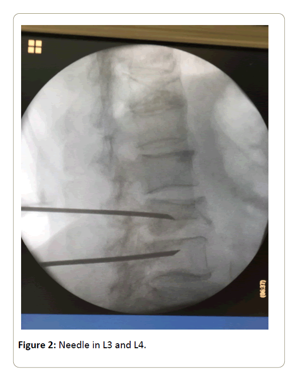 surgery-emergency-medicine-needle