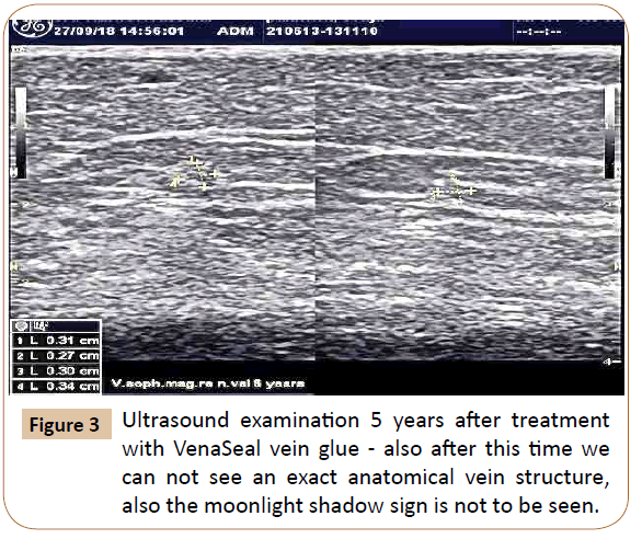 vascular-endovascular-therapy-exact-anatomical