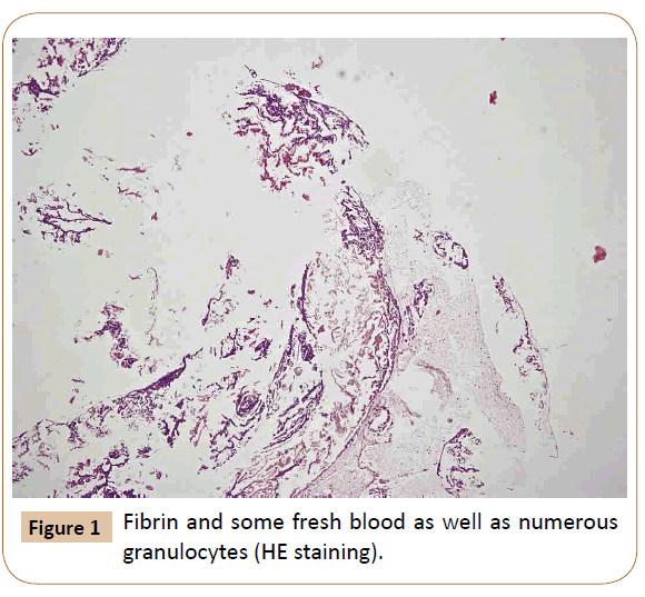 vascular-endovascular-therapy-fresh-blood