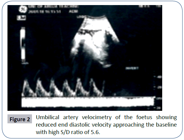 womens-health-reproductive-medicine-artery-velocimetry