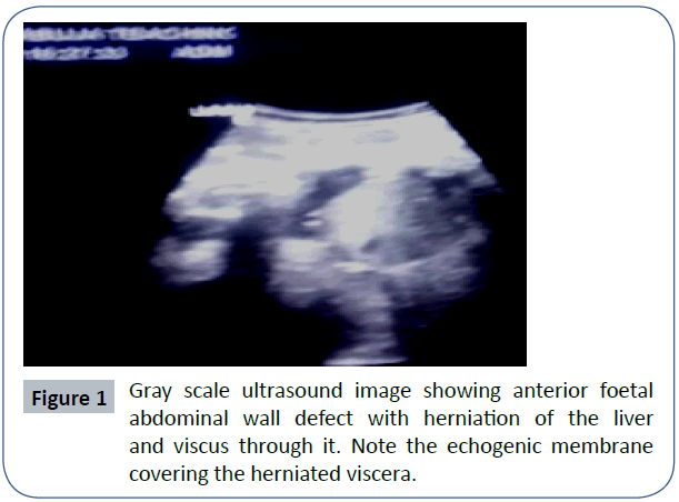 womens-health-reproductive-medicine-ultrasound-image