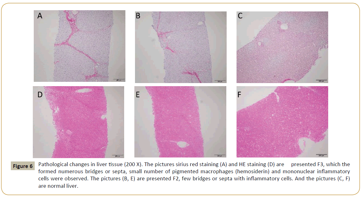 zoonotic-diseases-and-public-health-hepatic-pigmented-macrophages